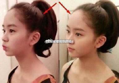 金在頭是什么意思【\