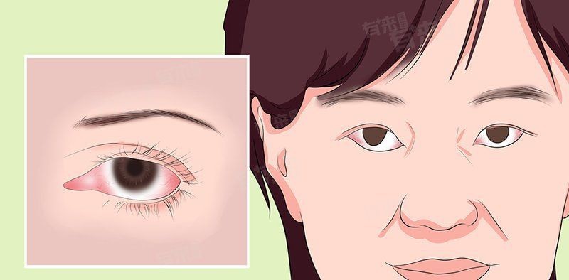 蒙眼病會傳染其他魚嗎？【紅眼病傳播途徑是什么】 蒙眼病會傳染其他魚嗎？【紅眼病傳播途徑是什么】 龍魚百科