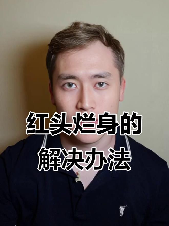 如何預防魚爛身病的再次發生？【冬季魚塘紅頭爛身原因及防治方法全民小視頻全民小視頻】 如何預防魚爛身病的再次發生？【冬季魚塘紅頭爛身原因及防治方法全民小視頻全民小視頻】 龍魚百科 第3張