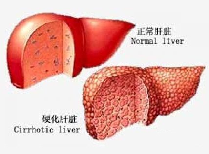 龍魚腹水抽水后多久會恢復？【龍魚腹水抽水后的恢復時間】 龍魚腹水抽水后多久會恢復？【龍魚腹水抽水后的恢復時間】 龍魚百科 第3張