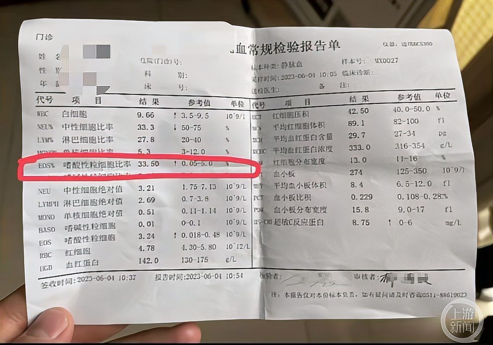 順德金雕魚生有寄生蟲嗎【順德金雕魚生寄生蟲感染肝吸蟲威脅正隨著食客的筷子蔓延】