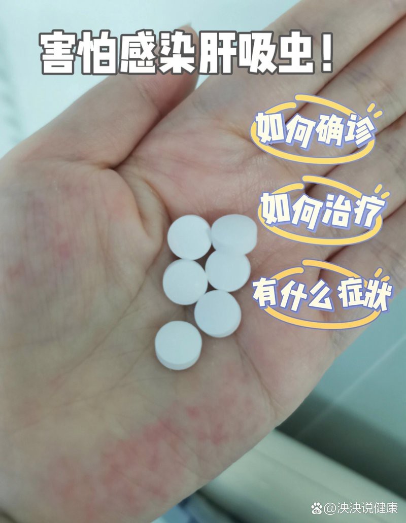順德金雕魚生有寄生蟲嗎【順德金雕魚生寄生蟲感染肝吸蟲威脅正隨著食客的筷子蔓延】