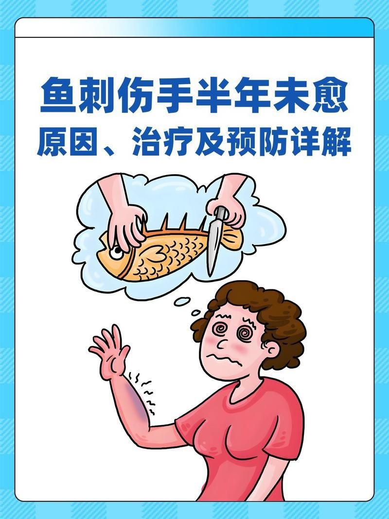 虎魚刺扎手了最怕三個東西