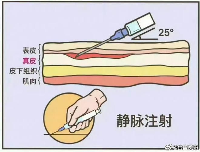 魟魚打針位置圖