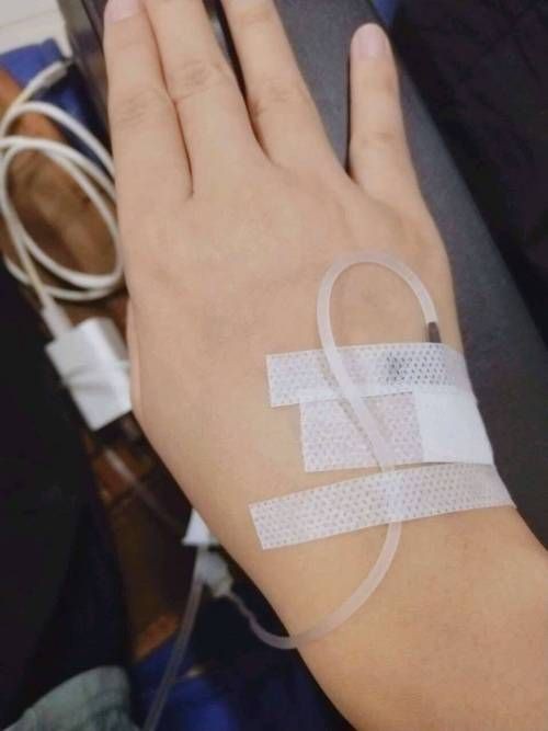 魟魚打針位置圖