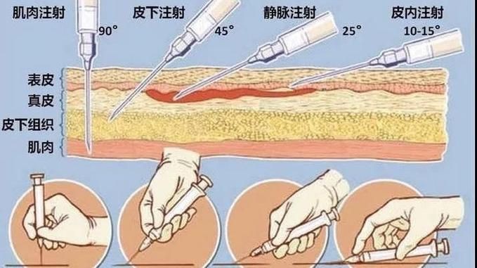 魟魚打針位置圖