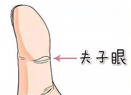 龍眼紋手相 龍眼紋手相 龍魚論壇 第6張