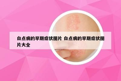 魚缸底濾的制作過程視頻：制作魚缸底濾的步驟包括：購買合適的底濾設備