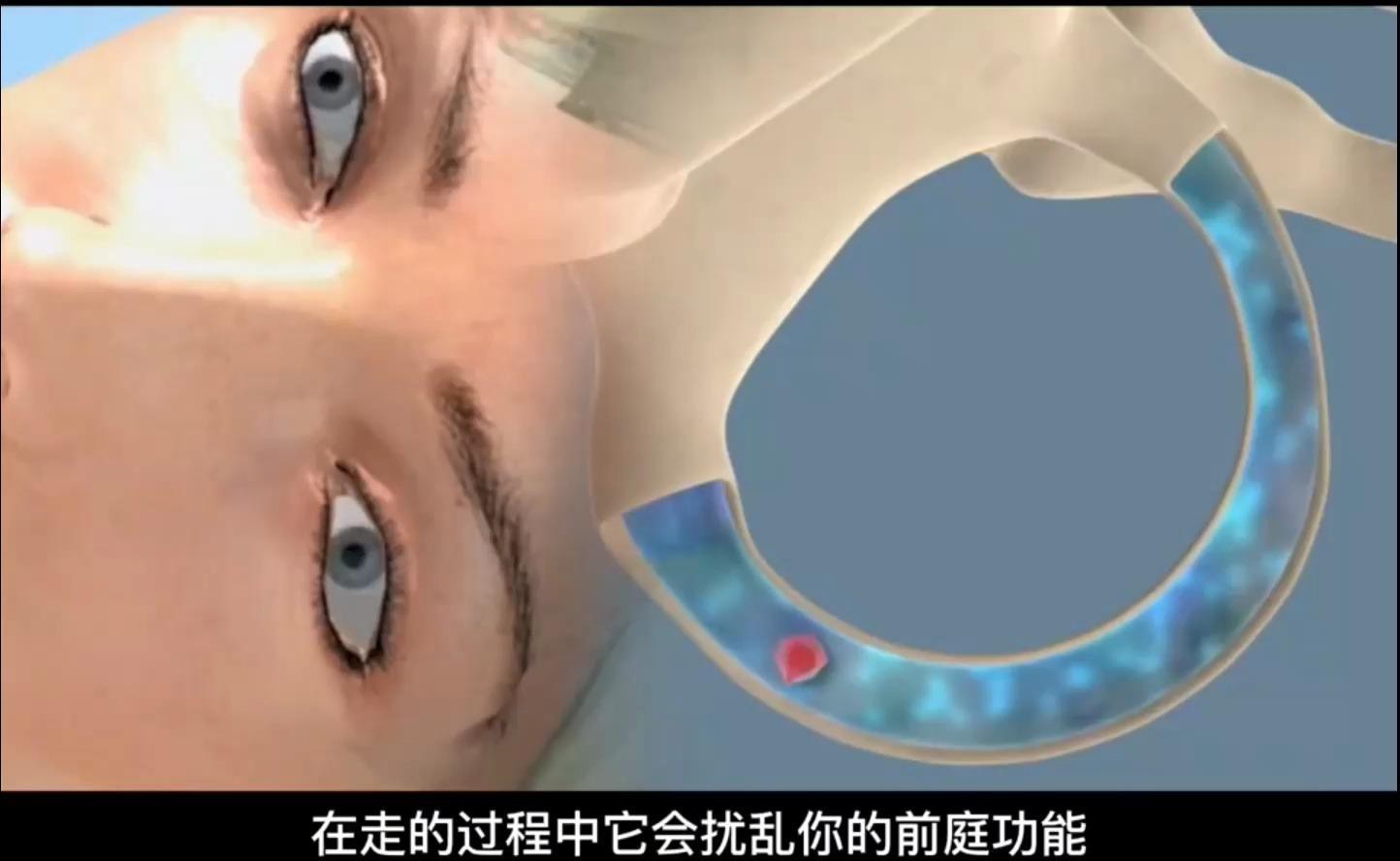 耳石鑒定法具體步驟是什么？