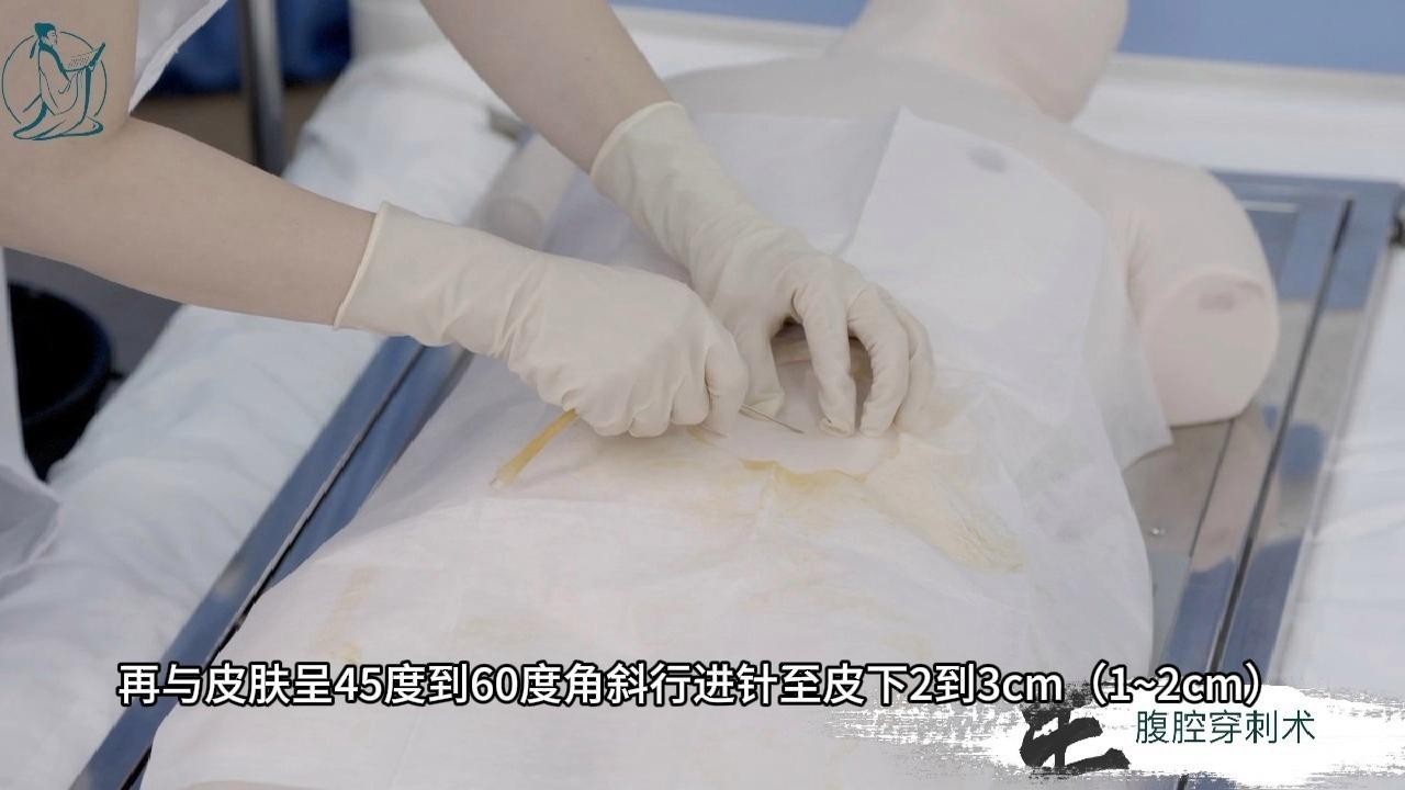 龍魚腹水穿刺抽液的風險有哪些？