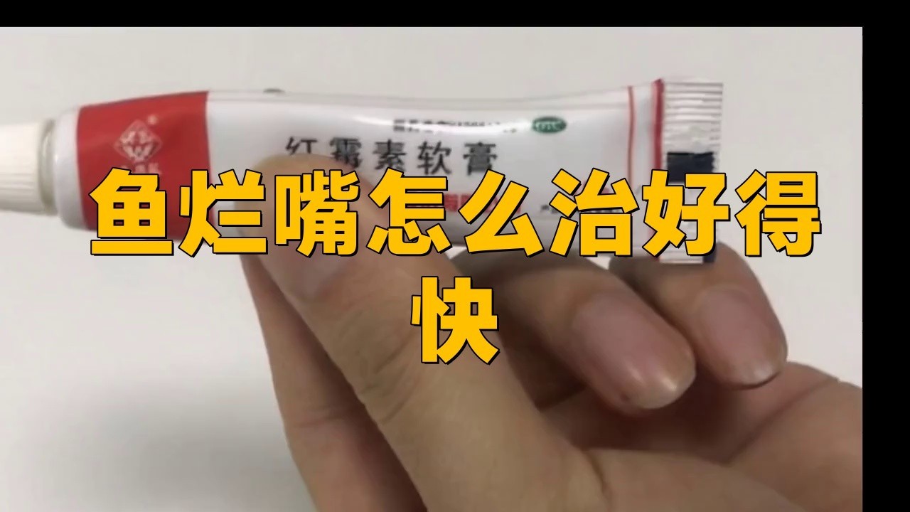 銀龍魚嘴巴前面爛掉了一塊怎么辦 銀龍魚嘴巴前面爛掉了一塊怎么辦 龍魚百科 第4張