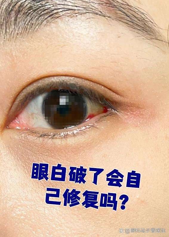 龍魚眼白膜破裂后多久會自愈？