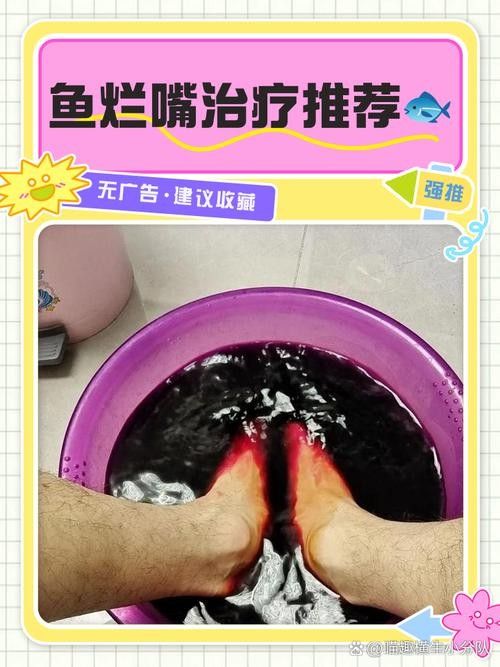 龍魚爛尾爛嘴怎么治療方法圖解 龍魚爛尾爛嘴怎么治療方法圖解 龍魚百科 第15張