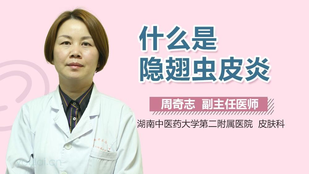 隱翅蟲皮炎如何治療？