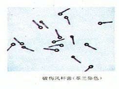 龍魚傷口感染會傳染嗎？