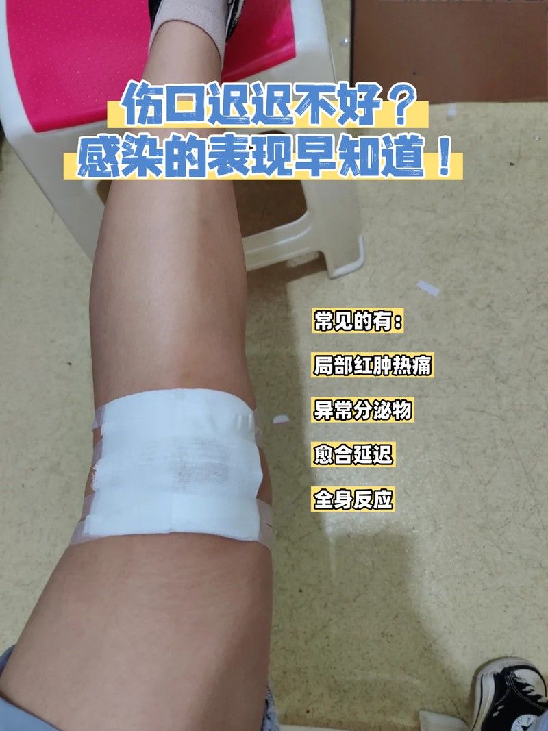 如何判斷過背金龍珠鱗損傷是否感染？ 如何判斷過背金龍珠鱗損傷是否感染？ 龍魚百科 第2張