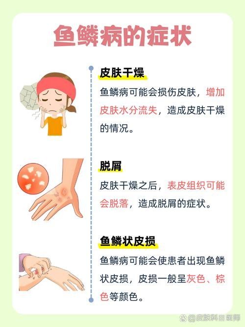 銀龍魚爛鱗怎么治療圖片大全圖解