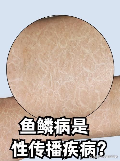 銀龍魚爛鱗怎么治療圖片大全圖解