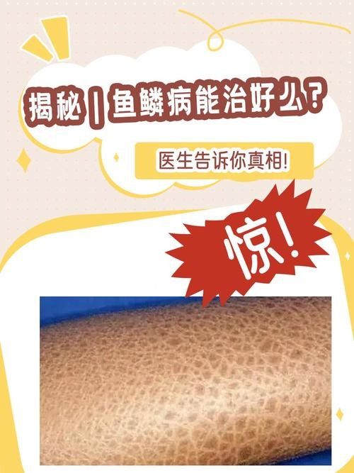 銀龍魚爛鱗怎么治療圖片大全圖解