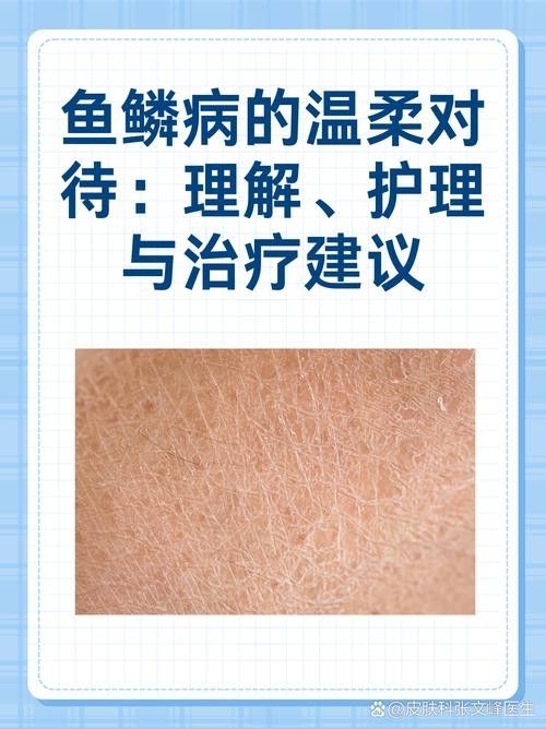 銀龍魚爛鱗怎么治療圖片大全圖解