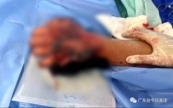 龍魚傷口感染多久會死？