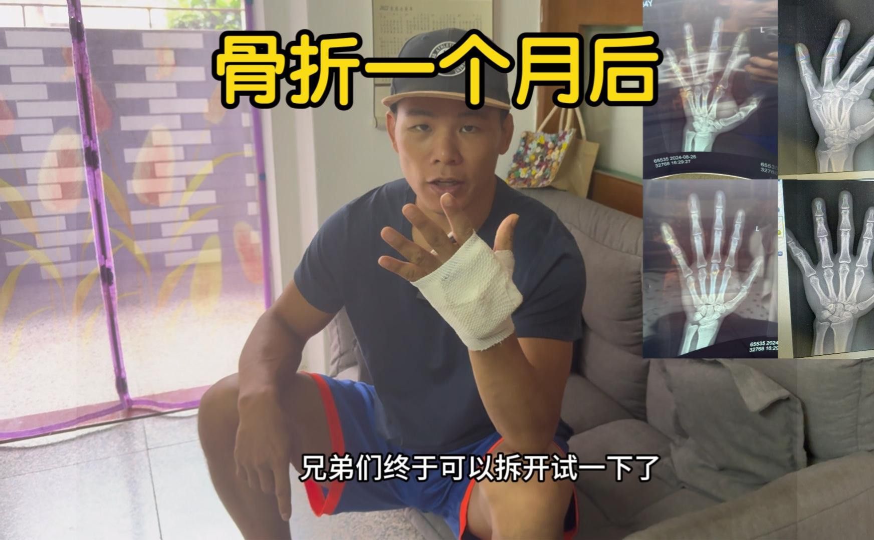 夾板治療期間需要多久換一次水？ 夾板治療期間需要多久換一次水？ 龍魚百科 第2張