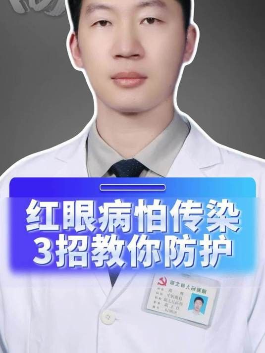 有沒(méi)有更簡(jiǎn)單的紅眼調(diào)整方法？