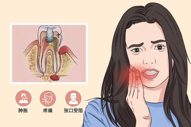 拔鱗手術需要多長時間恢復？