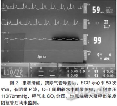 MS-222麻醉效果對比研究，ms-222與其他麻醉劑對比研究