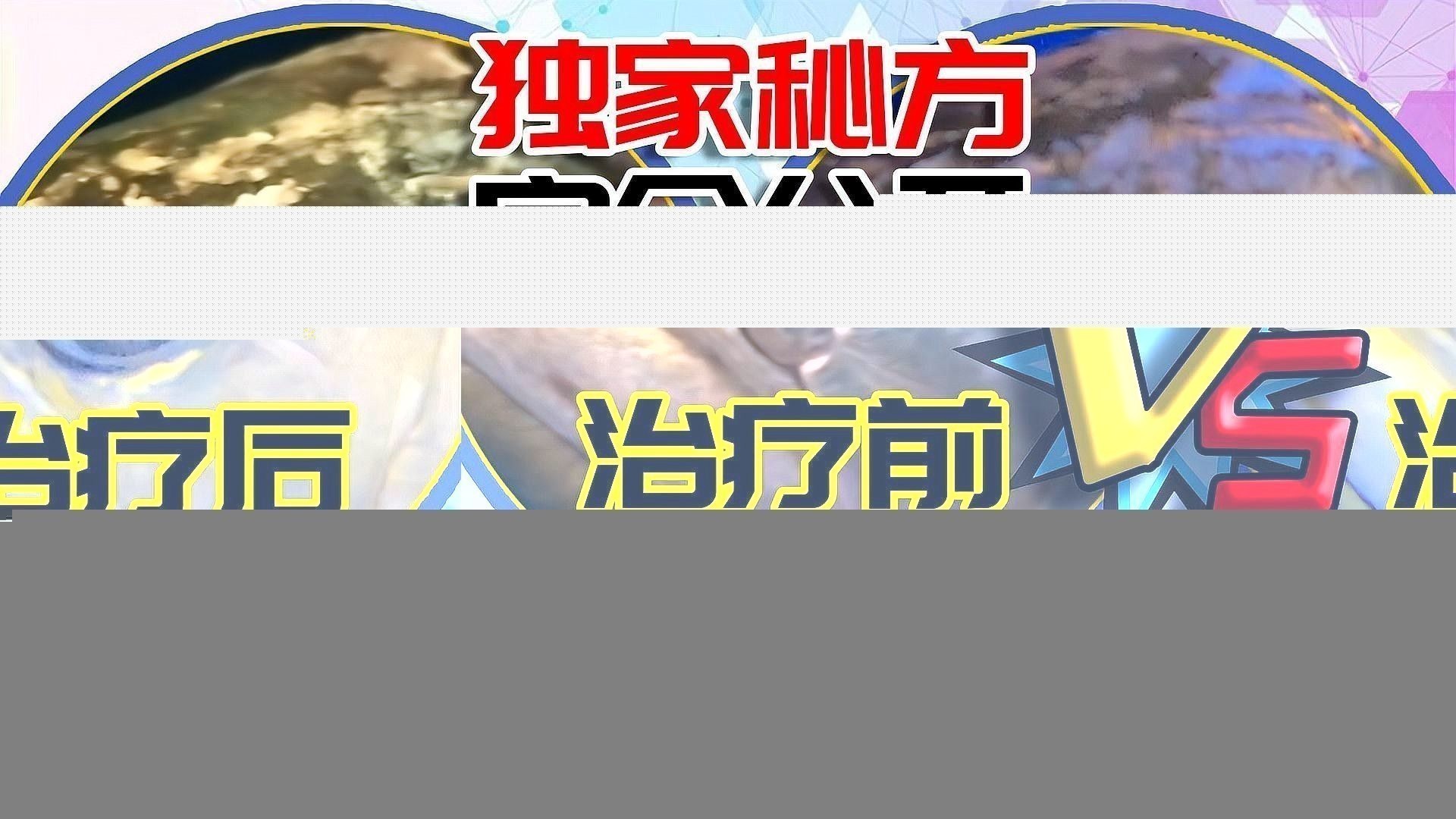 龍魚蒙眼嚴(yán)重怎么辦啊