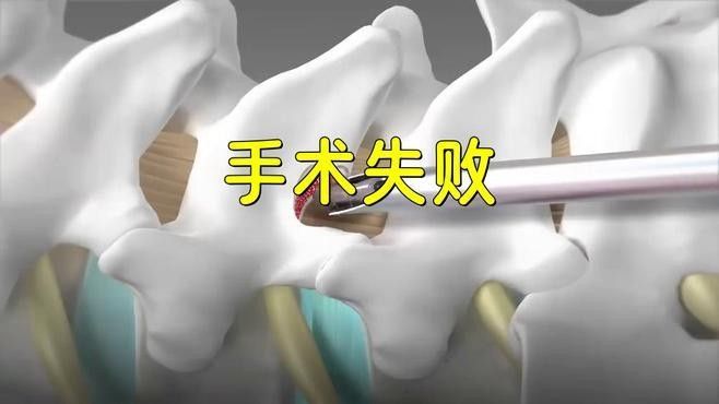 銀龍魚掉眼手術 銀龍魚掉眼手術 龍魚百科 第1張