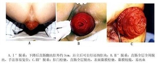 龍魚粘液癥（龍魚粘液癥怎么辦）