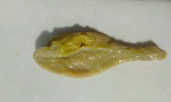 龍魚(yú)吐絮狀物（龍魚(yú)吐絮狀物可能由多種原因引起，）
