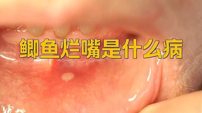 銀龍魚身上有紅點怎么辦 銀龍魚身上有紅點怎么辦 龍魚百科 第5張