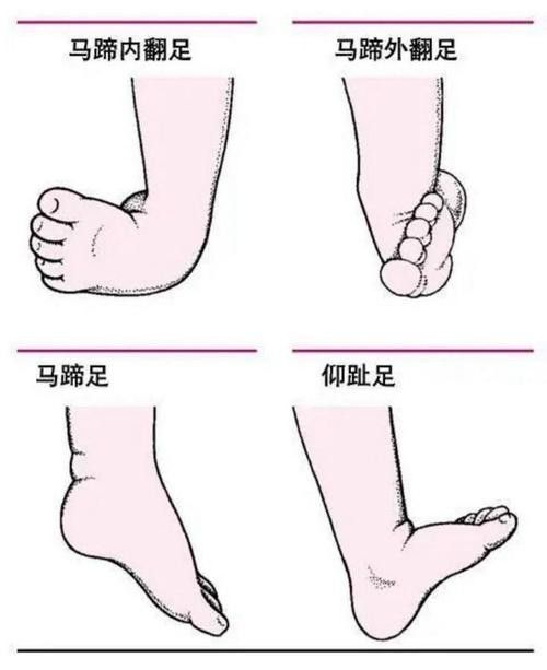 紅龍魚馬蹄印圖解