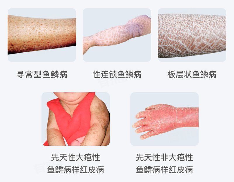 魚鱗病的癥狀有哪些？ 魚鱗病的癥狀有哪些？ 龍魚百科 第5張