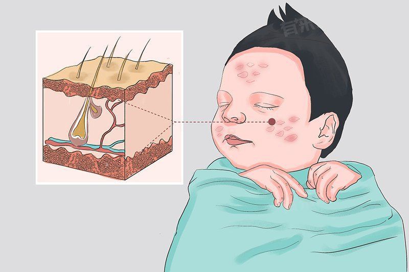 魚鱗病的癥狀有哪些？ 魚鱗病的癥狀有哪些？ 龍魚百科 第6張