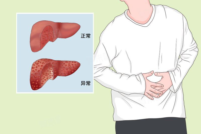 不同病因的腹水有何區別 不同病因的腹水有何區別 龍魚百科 第7張