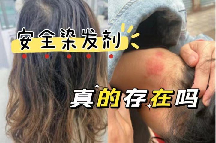 紅龍染發(fā)劑有哪些副作用？