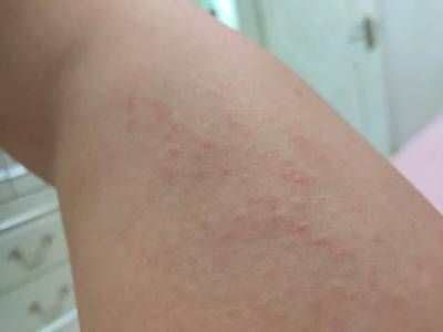 龍魚身上長白疙瘩怎么辦：龍魚身上出現(xiàn)白疙瘩可能是由多種原因引起的，如何預(yù)防