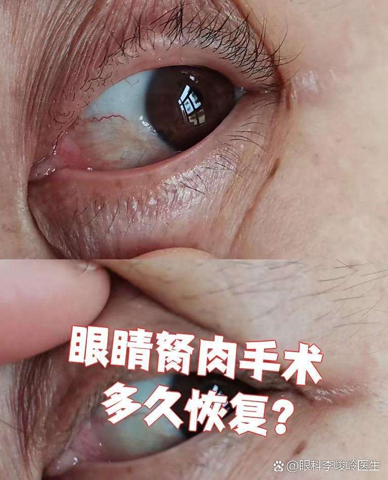 龍魚眼睛凸起手術后多久會恢復？