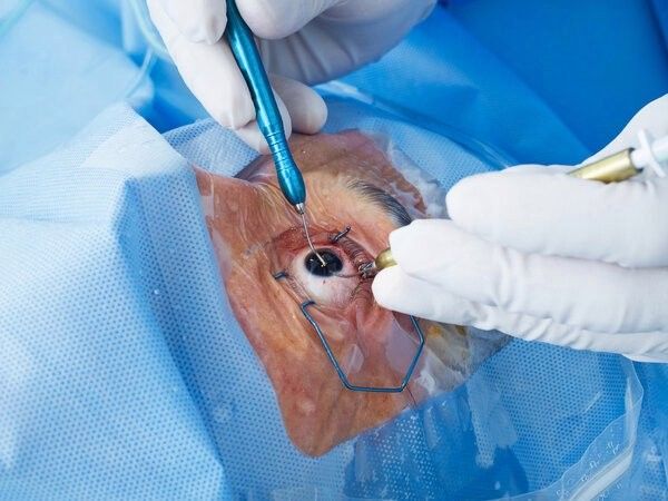 龍魚眼睛凸起手術后多久會恢復？