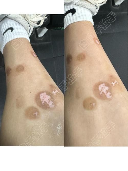 銀龍魚鼻子爛圖片真實(shí)