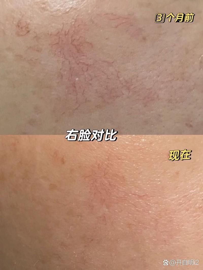 銀龍魚鼻子爛圖片真實(shí)