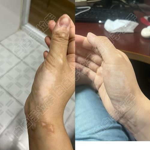 銀龍魚鼻子爛圖片真實(shí)