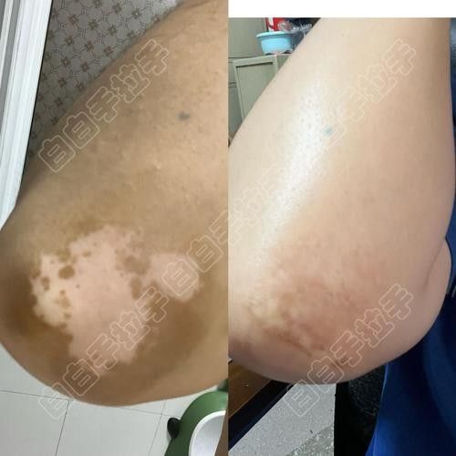 銀龍魚鼻子爛圖片真實(shí)