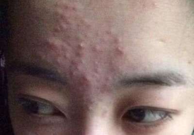 龍魚下巴長疙瘩咋回事（龍魚下巴長疙瘩是怎么回事？） 龍魚下巴長疙瘩咋回事（龍魚下巴長疙瘩是怎么回事？） 龍魚百科 第4張