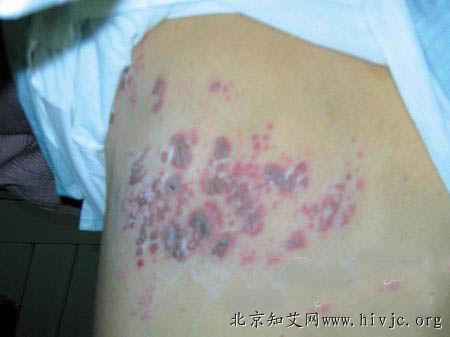 龍魚背部長疙瘩【龍魚背部長疙瘩可能由多種原因造成】