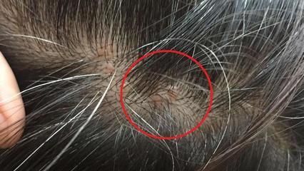 龍魚背部長疙瘩【龍魚背部長疙瘩可能由多種原因造成】