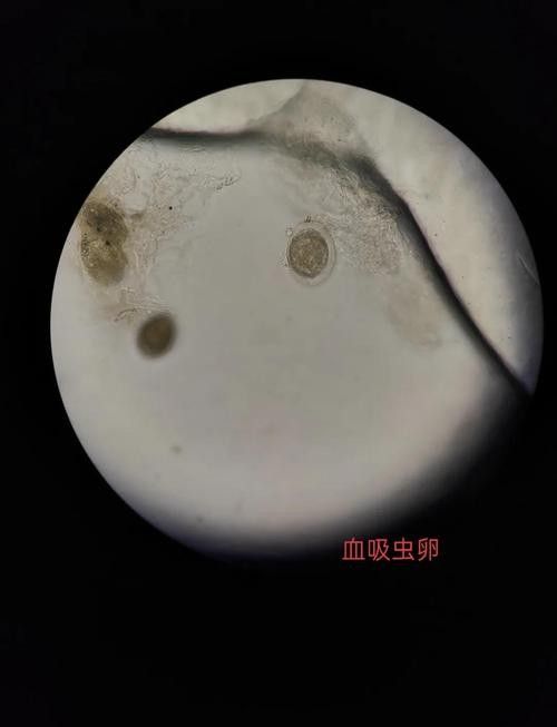 龍魚身上白色線狀寄生蟲圖片 龍魚身上白色線狀寄生蟲圖片 龍魚百科 第38張